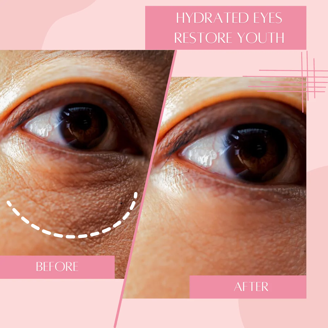 Hydrating Under Eye Mask [Reusable] by Dreambox Beauty - Image 5
